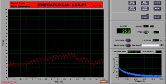 Fig.4　Computer display of FFT laser blood flowmeter